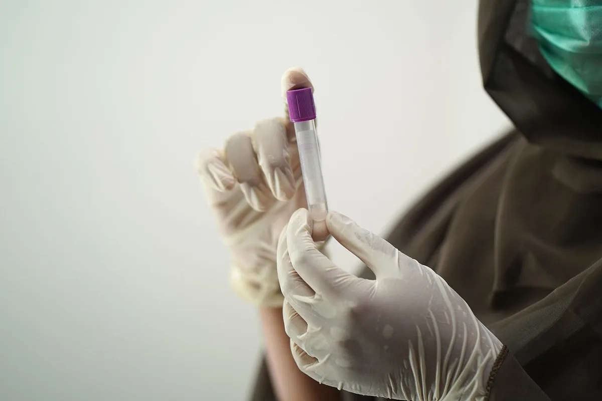 Module OBD branché sur la prise diagnostic d'un véhicule